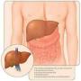 Health information why Hepatitus C is called silent killer