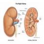 Top reason of kidney failure in human Symptoms of Kidney Failure How to cure Kidney Failure Disease